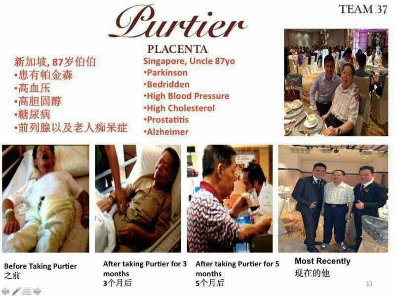 Testimoni Purtier Placenta